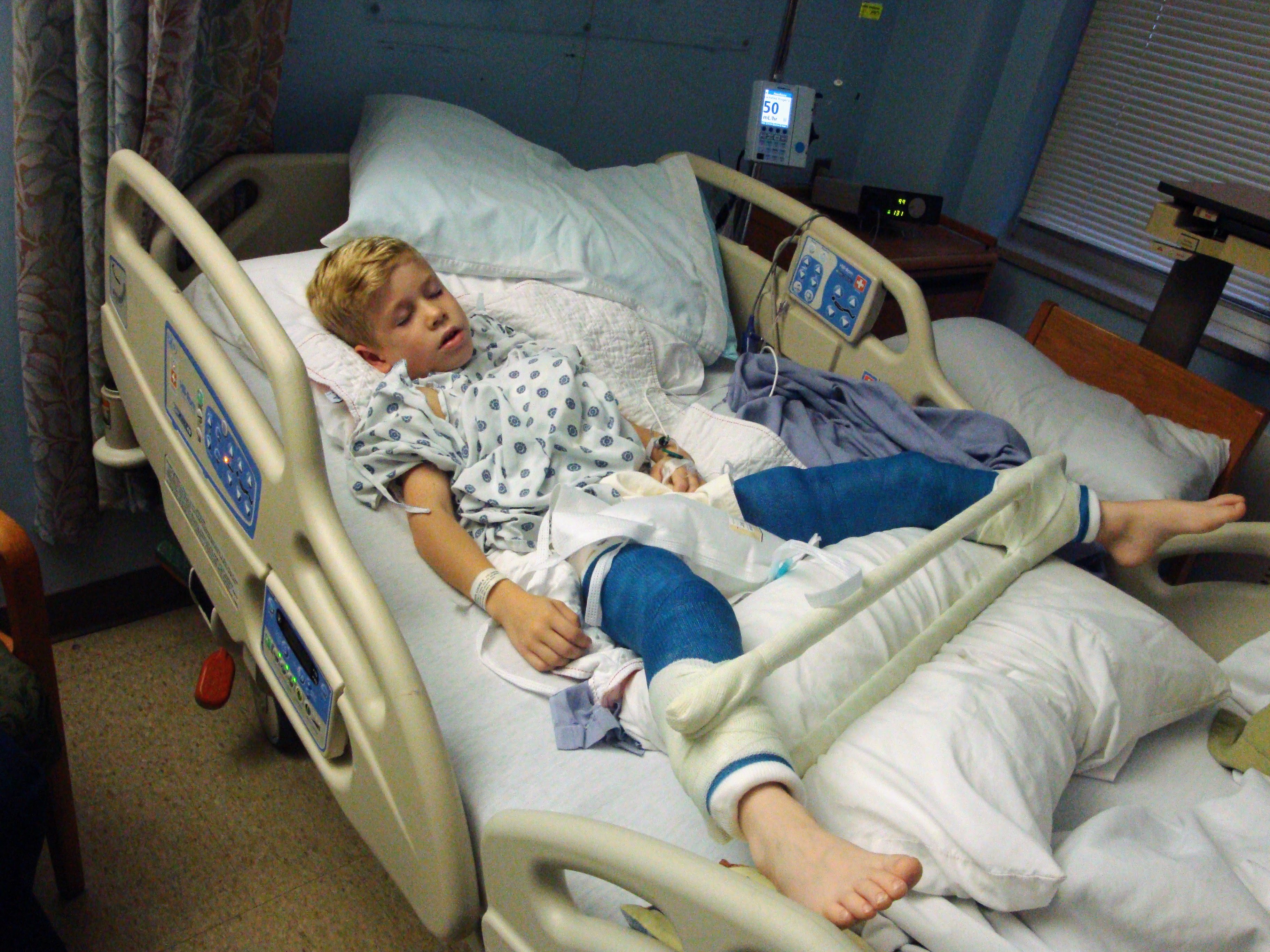 Luke as a young boy asleep in a hospital bed after hip surgery, both legs in blue casts on pillows